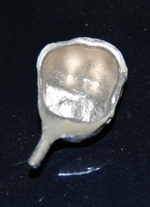 Visione metallo di una cappetta in lega palladio-argento, priva di ossidi, trattata secondo il protocollo TTSVGEL, ceramizzata,